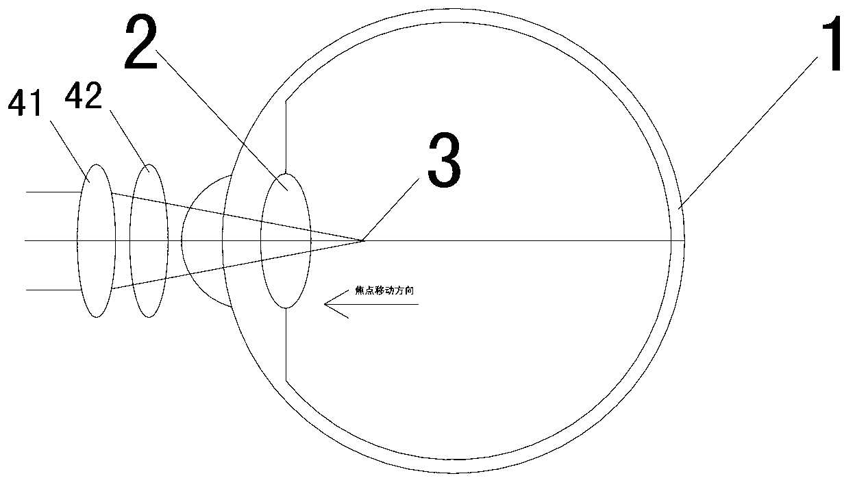 Lens combination method for adjusting intraocular optical focal positions