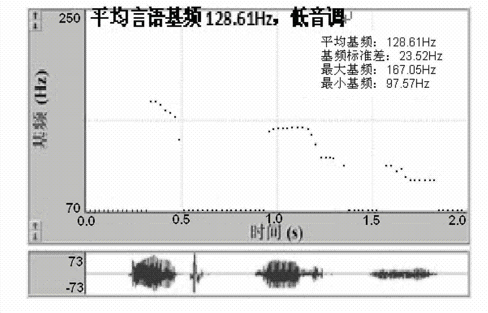 Rehabilitation system and method based on real-time audio-visual feedback and promotion technology for speech production