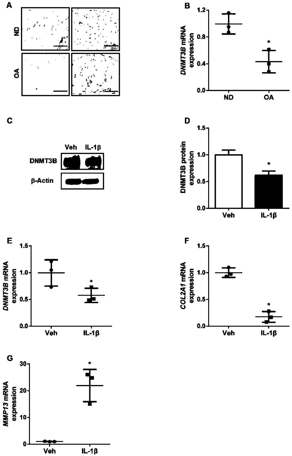 Application of amygdalin in preparing knee osteoarthritis anti-inflammatory drug