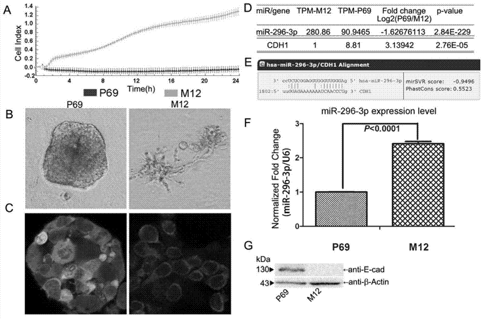 Application of miR-296-3p to preparation of kit for diagnosing prostate cancer generation or migration