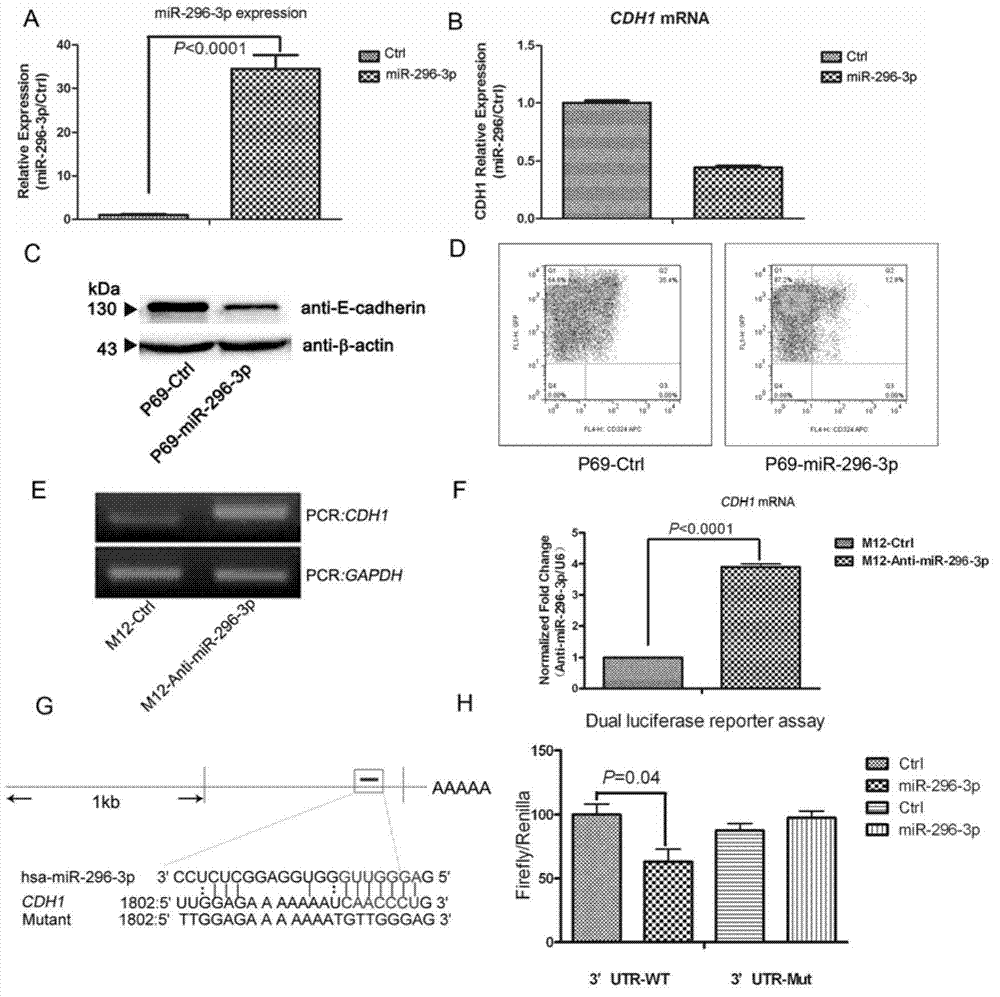 Application of miR-296-3p to preparation of kit for diagnosing prostate cancer generation or migration