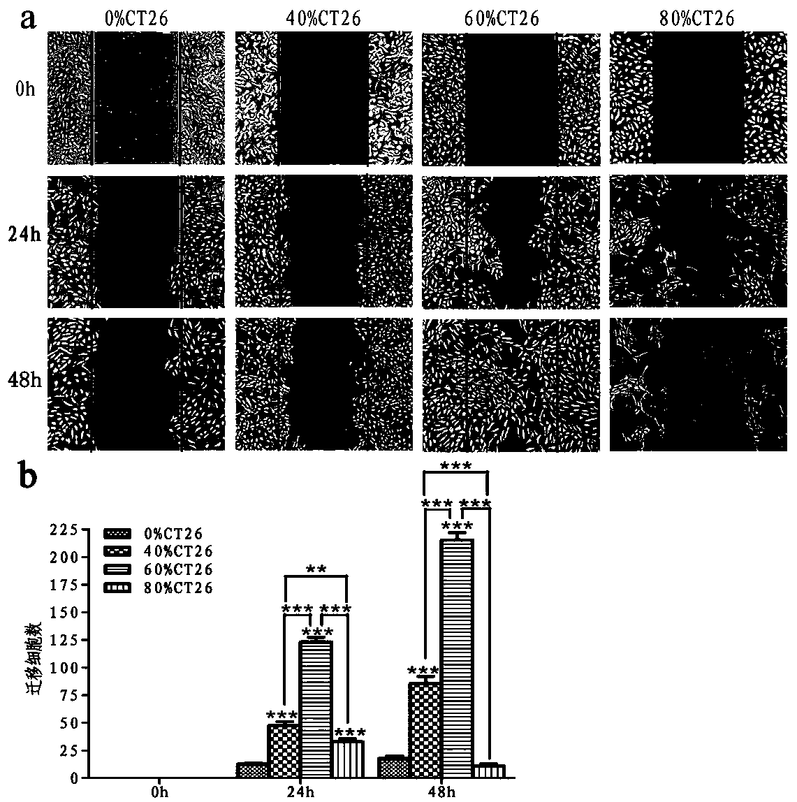 Tumorized human umbilical vein endothelial cell vaccine and its application in anticancer