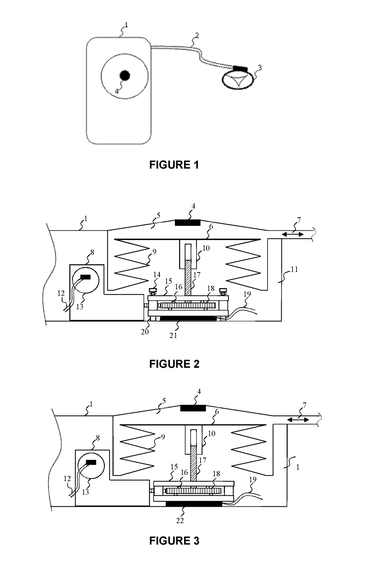 Implantable occlusion system