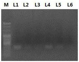 Prostate cancer early diagnosis or prognosis evaluation marker lncRNA malat1 and application thereof