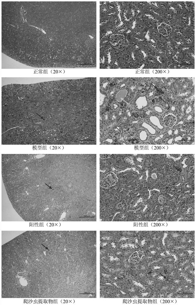 Hellgrammites extract for treating chronic renal failure as well as preparation method and application of hellgrammites extract