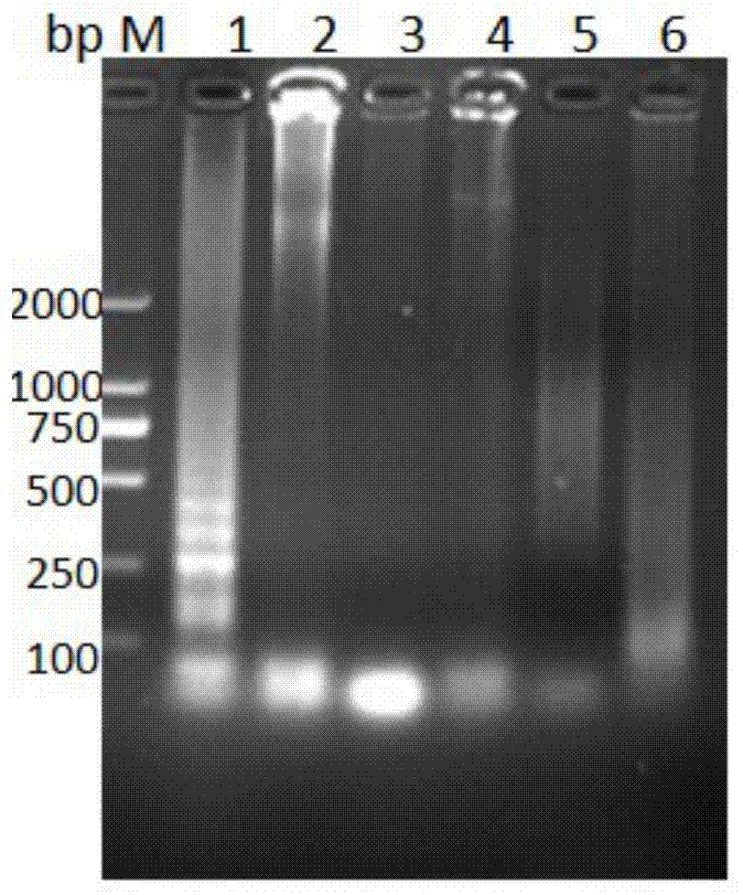 RT-LAMP (Reverse Transcription Loop-mediated Isothermal Amplification) nucleic acid test strip kit for detecting Japanese B encephalitis virus and application of kit