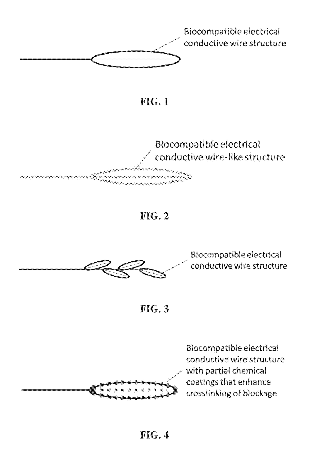 Radio frequency electro-thrombectomy device