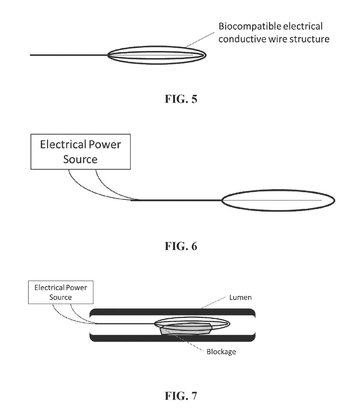 Radio frequency electro-thrombectomy device