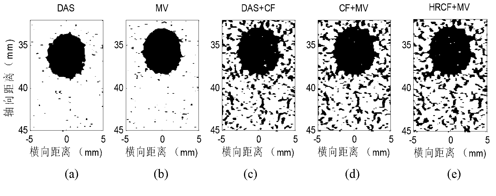 MV (Minimum variance) wave beam formation and MV-based CF (correlation factor) fusion method