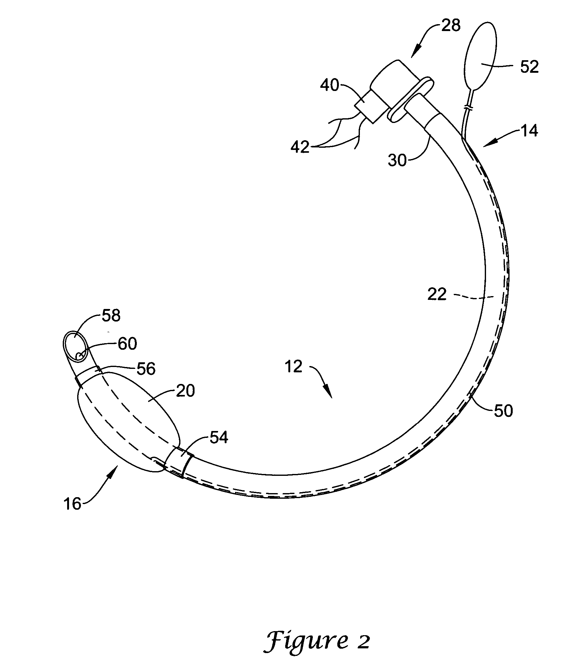 Ultrasonic placement and monitoring of an endotracheal tube