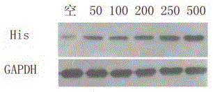 Product expressed by housefly embryonic cell construction antibacterial peptide attacin eukaryotic expression system and construction method