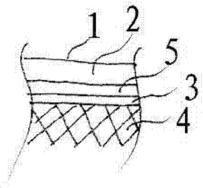 Implant comprising a non-woven fabric