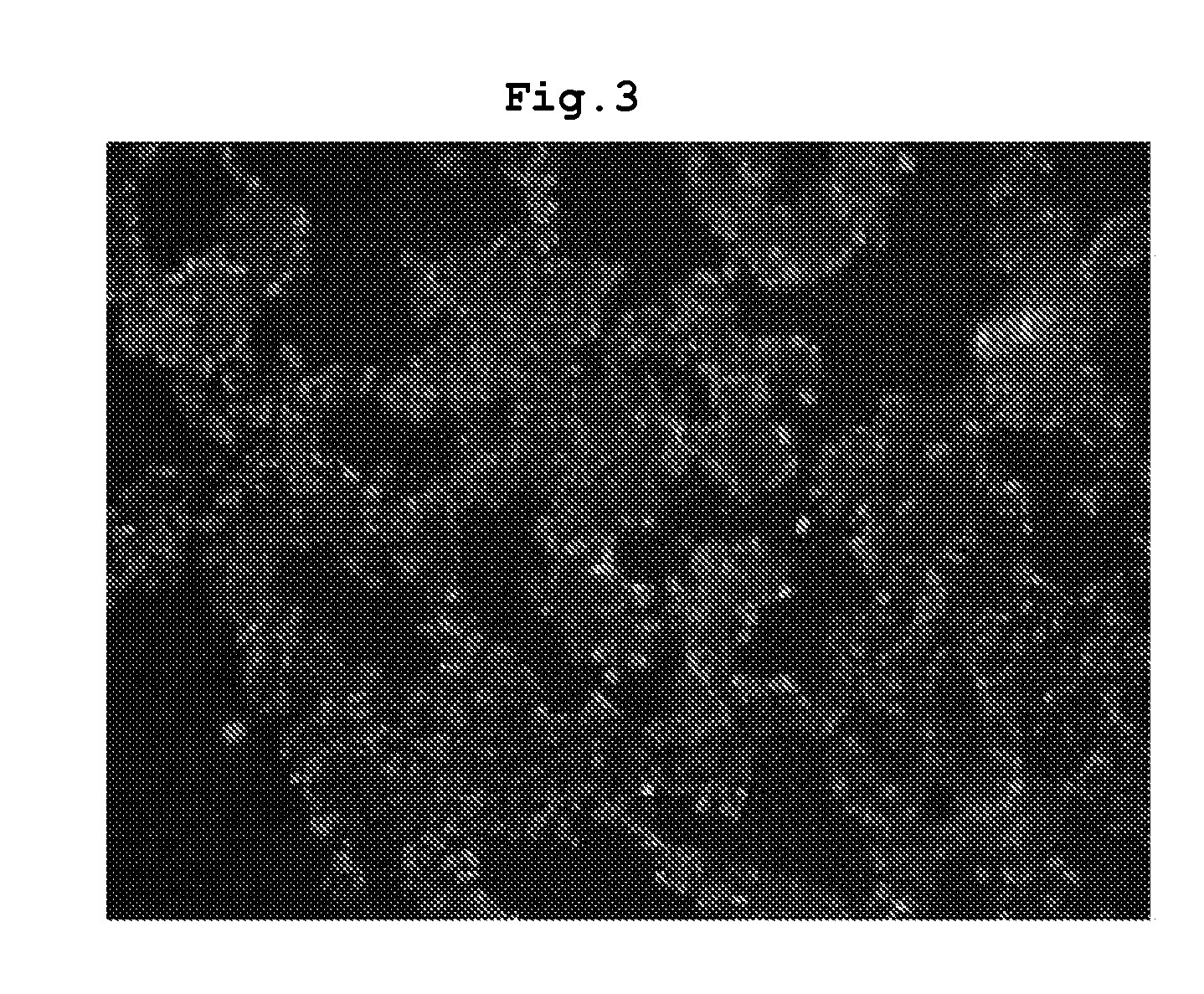 Composition Comprising Separated or Proliferated Cells from Umbilical Cord Blood for Treating Developmental and/or Chronic Lung Disease