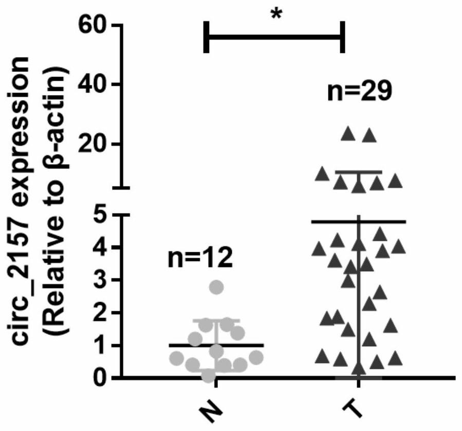 Application of circ_2157 in the preparation of nasopharyngeal carcinoma treatment preparations and therapeutic preparations