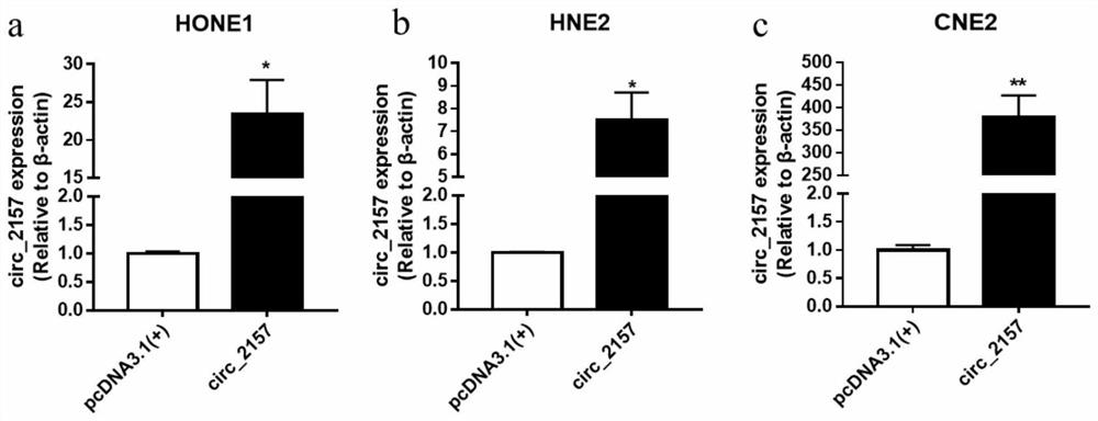 Application of circ_2157 in the preparation of nasopharyngeal carcinoma treatment preparations and therapeutic preparations