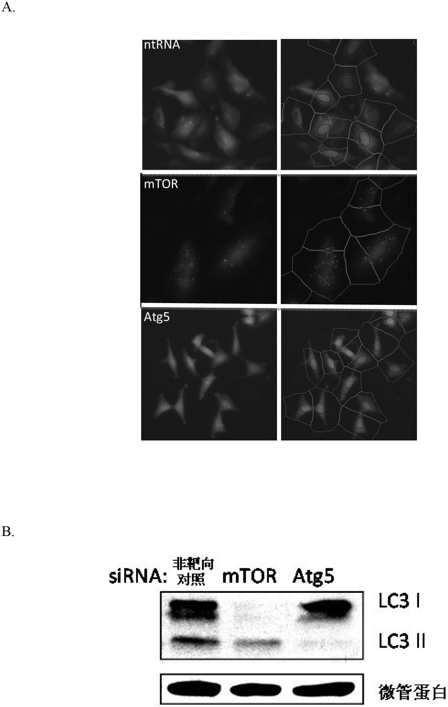 Methods for modulation of autophagy through the modulation of autophagy-enhancing gene products