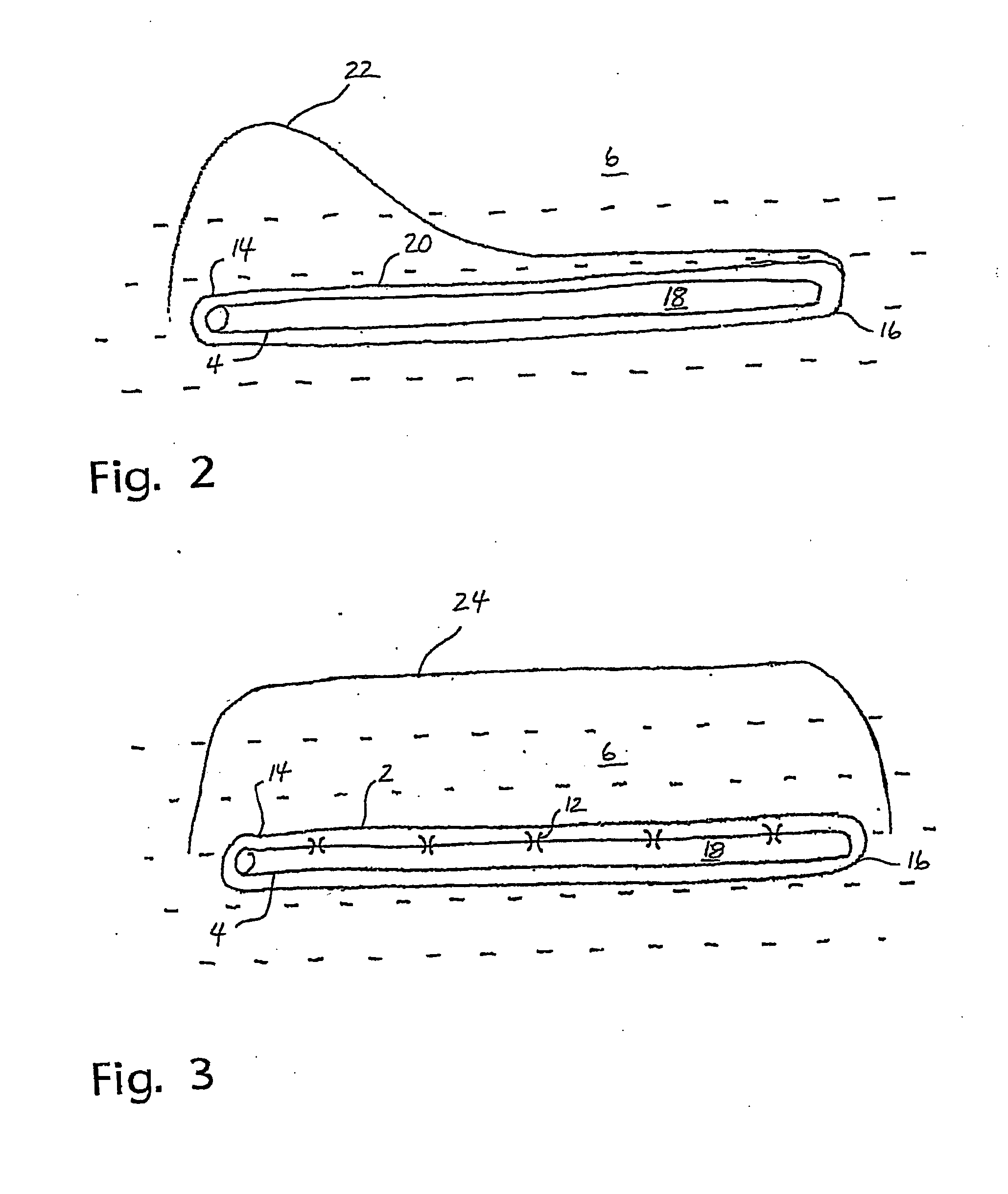 Flow control device for an injection pipe string