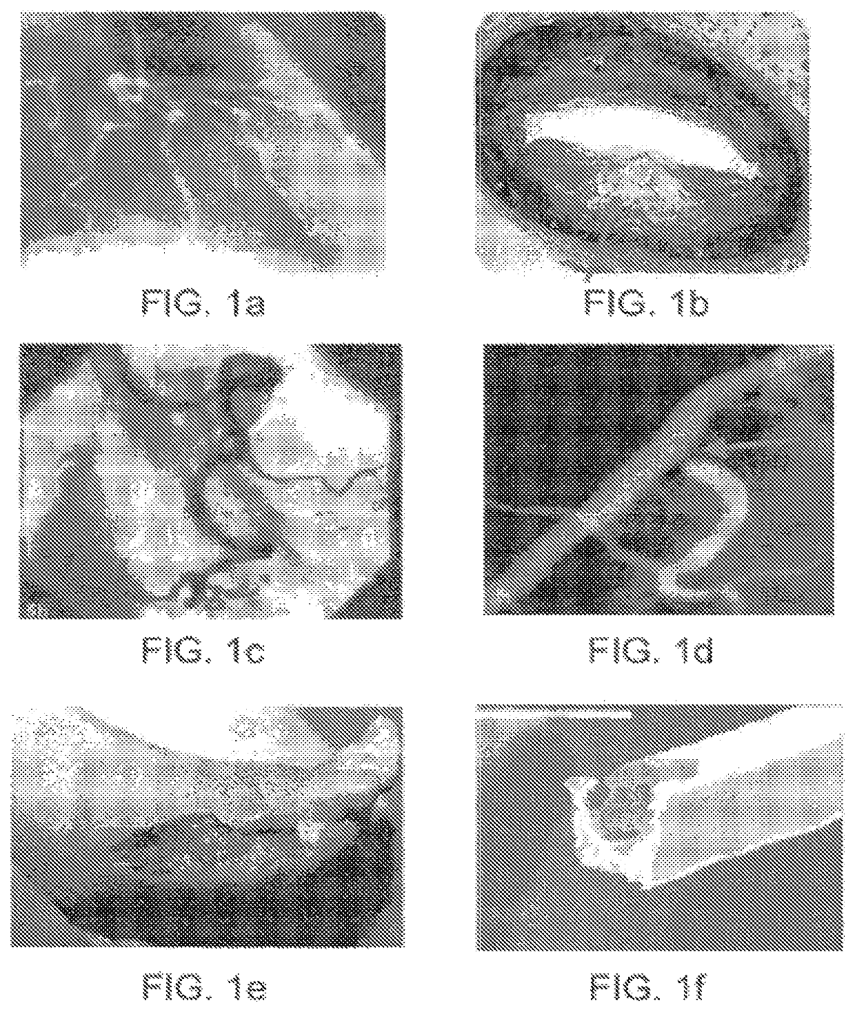 Apparatus and method for treatment of in-stent restenosis