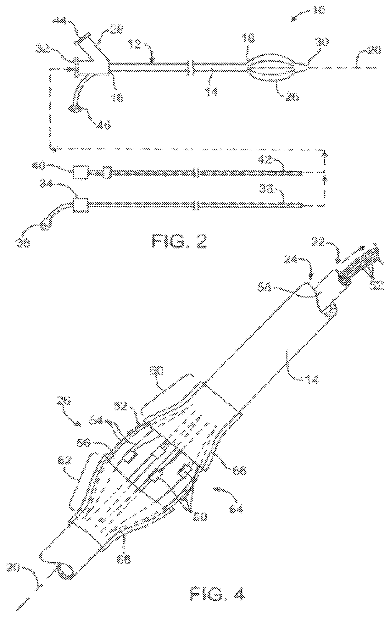 Apparatus and method for treatment of in-stent restenosis