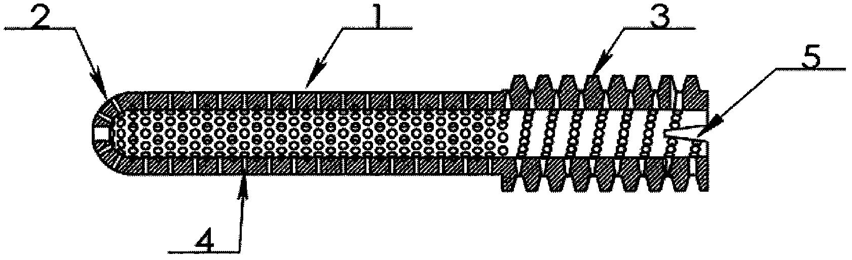 Inner supporting frame for femoral head