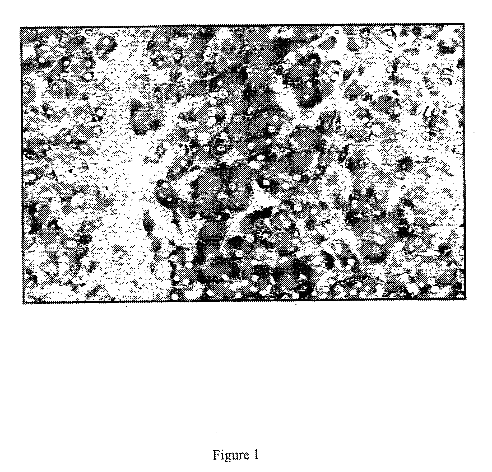 Epitopes in viral envelope proteins and specific antibodies directed against these epitopes: use for detection of HCV viral antigen in host tissue