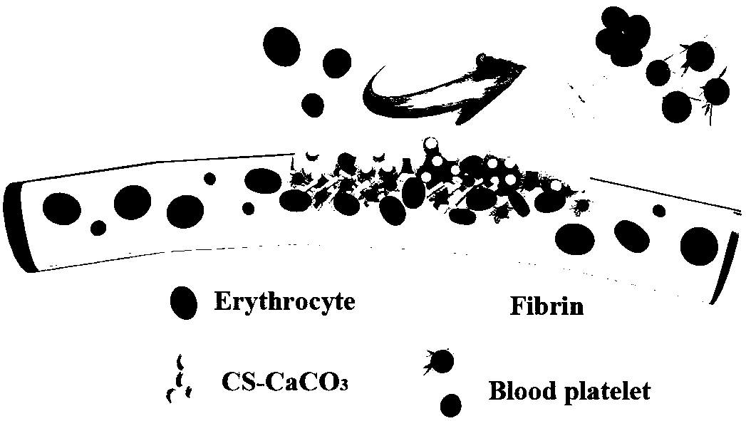 Efficient hemostatic material capable of promoting wound healing and preparation method thereof