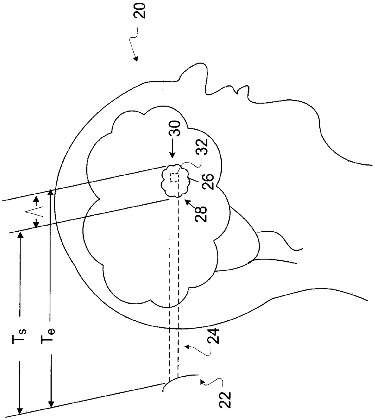 Dose-distribution estimation in proton therapy