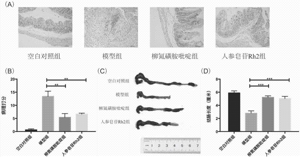 Application of ginsenoside Rh2 in preparation of medicines for preventing and treating inflammatory bowel diseases