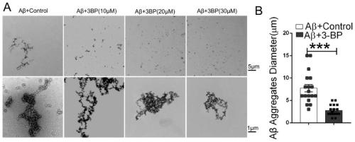 Application of hexokinase inhibitor to preparation of medicine for preventing and/or treating Alzheimer disease