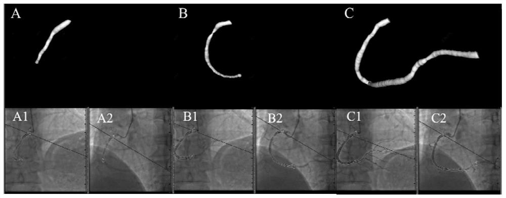 Detection method of guide wire-free FFR, guidewire-free IMR and guidewire-free CFR