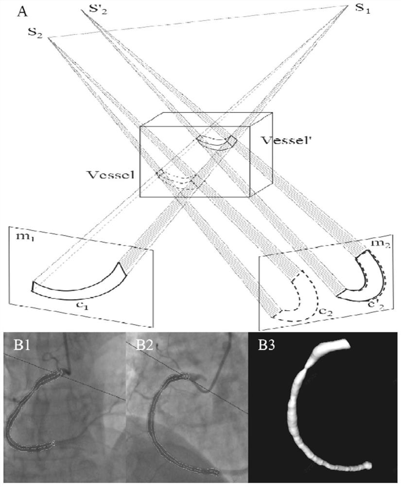 Detection method of guide wire-free FFR, guidewire-free IMR and guidewire-free CFR