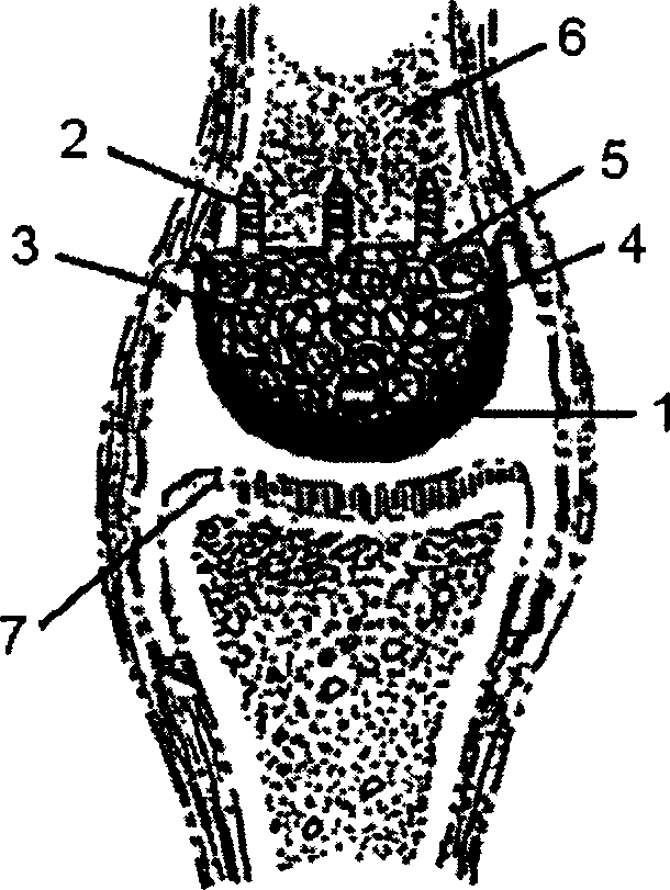 Compound artificial joint with artificial cartilage structure