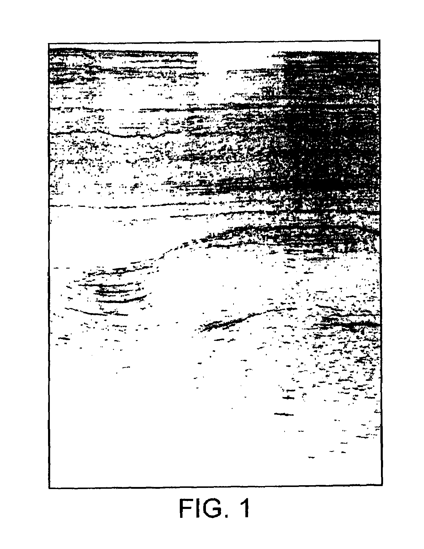 Method of seismic signal processing