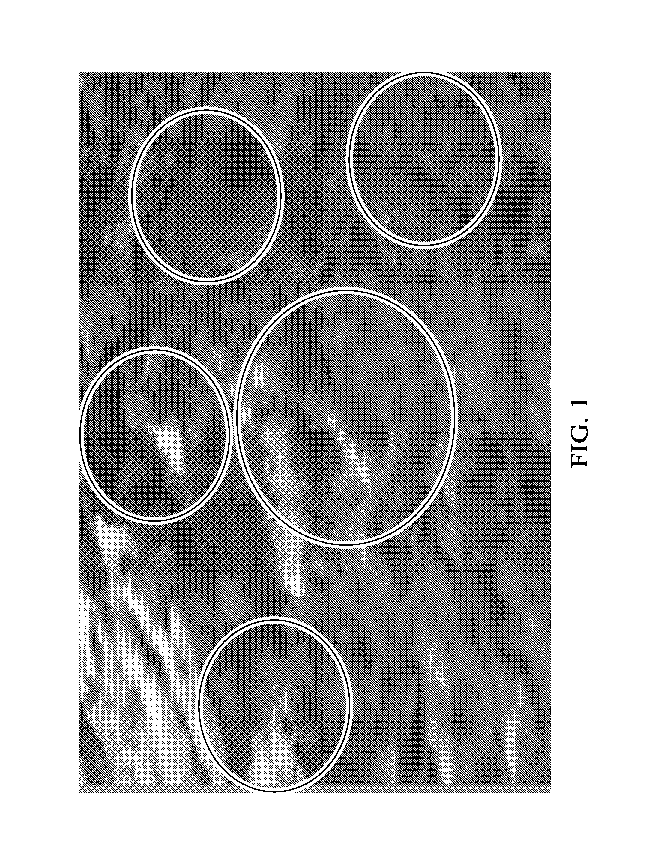 Block Artifact Suppression in Video Coding