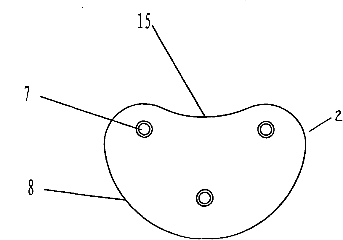 Spinal posterior approach dynamic stabilizing device