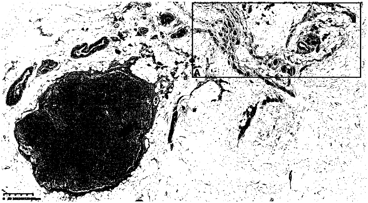 Preparation method of lymph node tissue slice