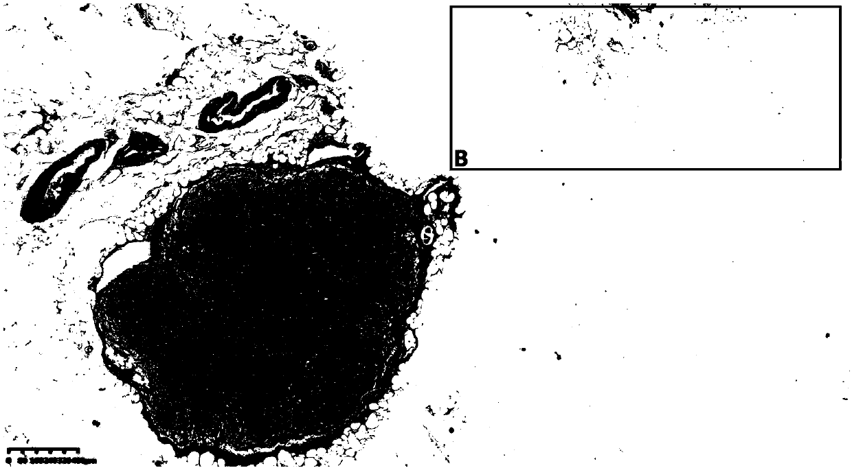 Preparation method of lymph node tissue slice