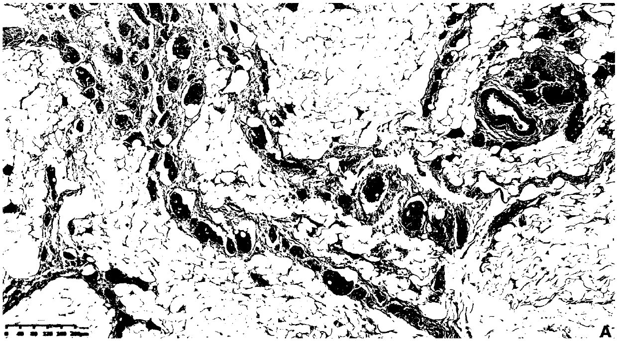 Preparation method of lymph node tissue slice