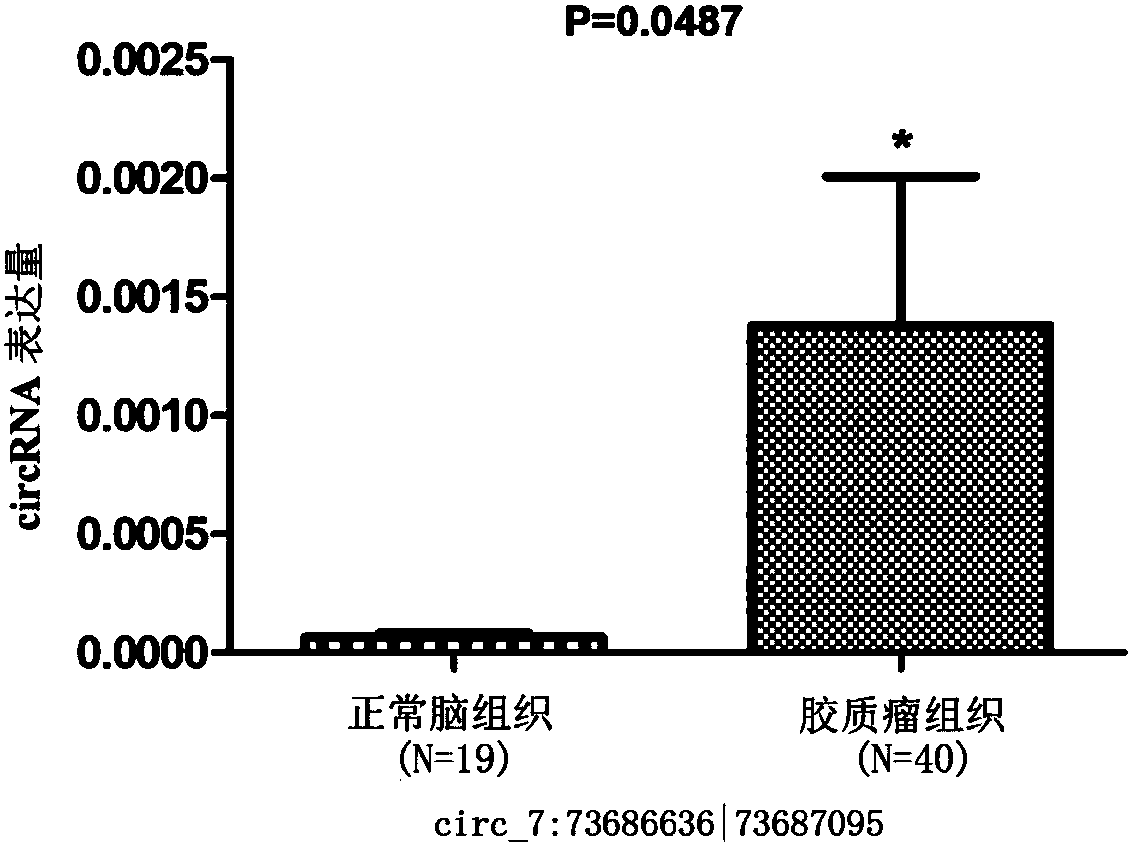 Glioma prognostic marker circ 7:73686636|73687095 and application