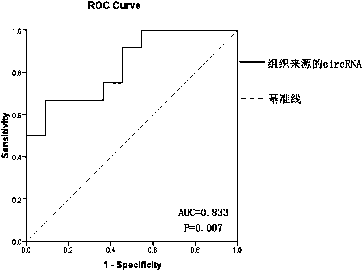 Glioma prognostic marker circ 7:73686636|73687095 and application