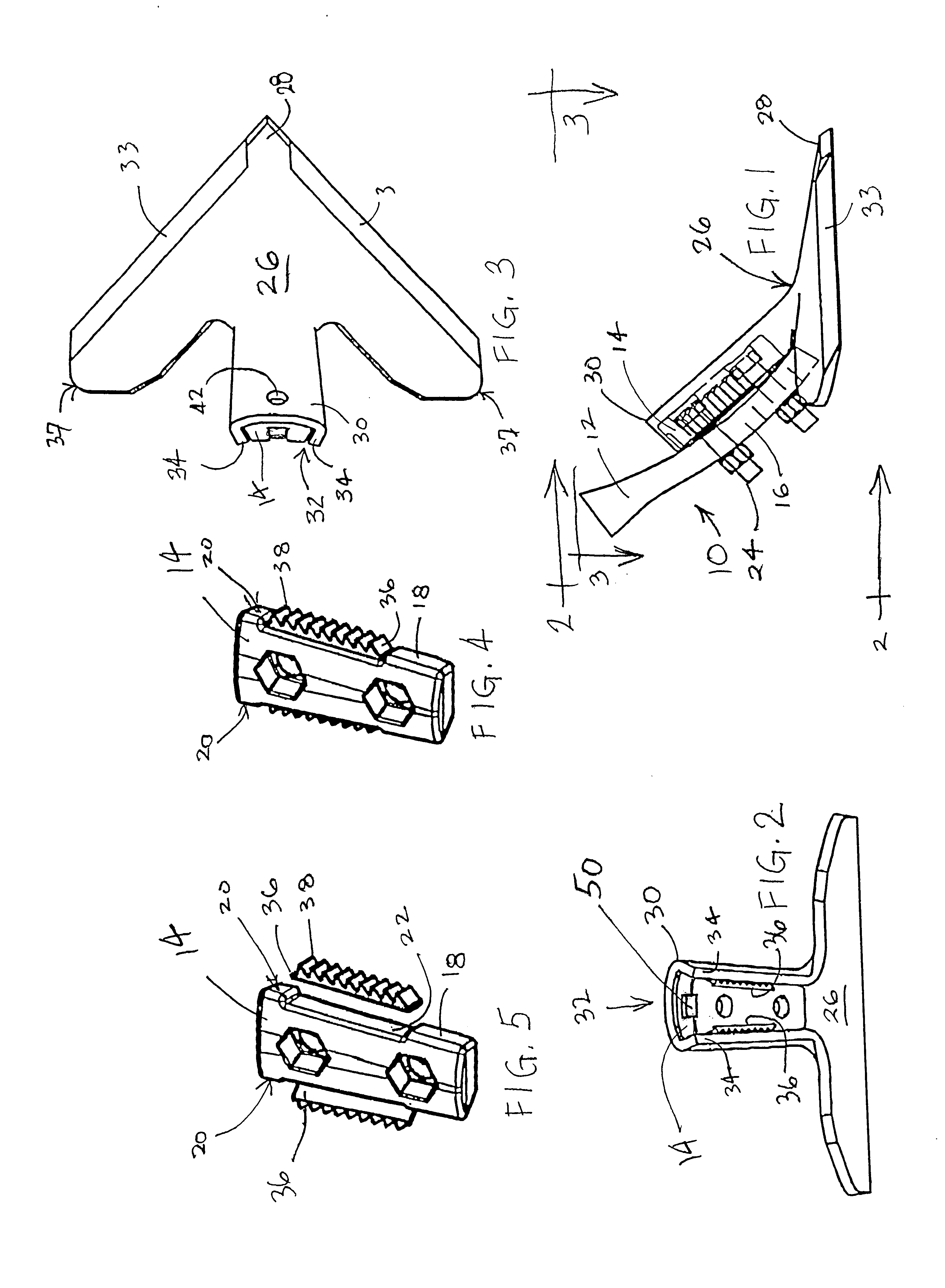 Soil-working implement having quick-change sweep design