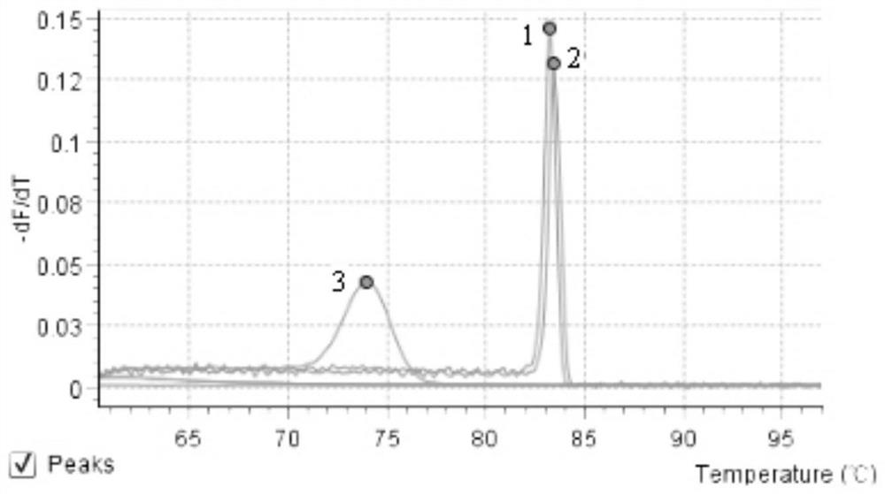 A fox retrovirus sybr Green Ⅰ fluorescent RT-PCR kit and its application method