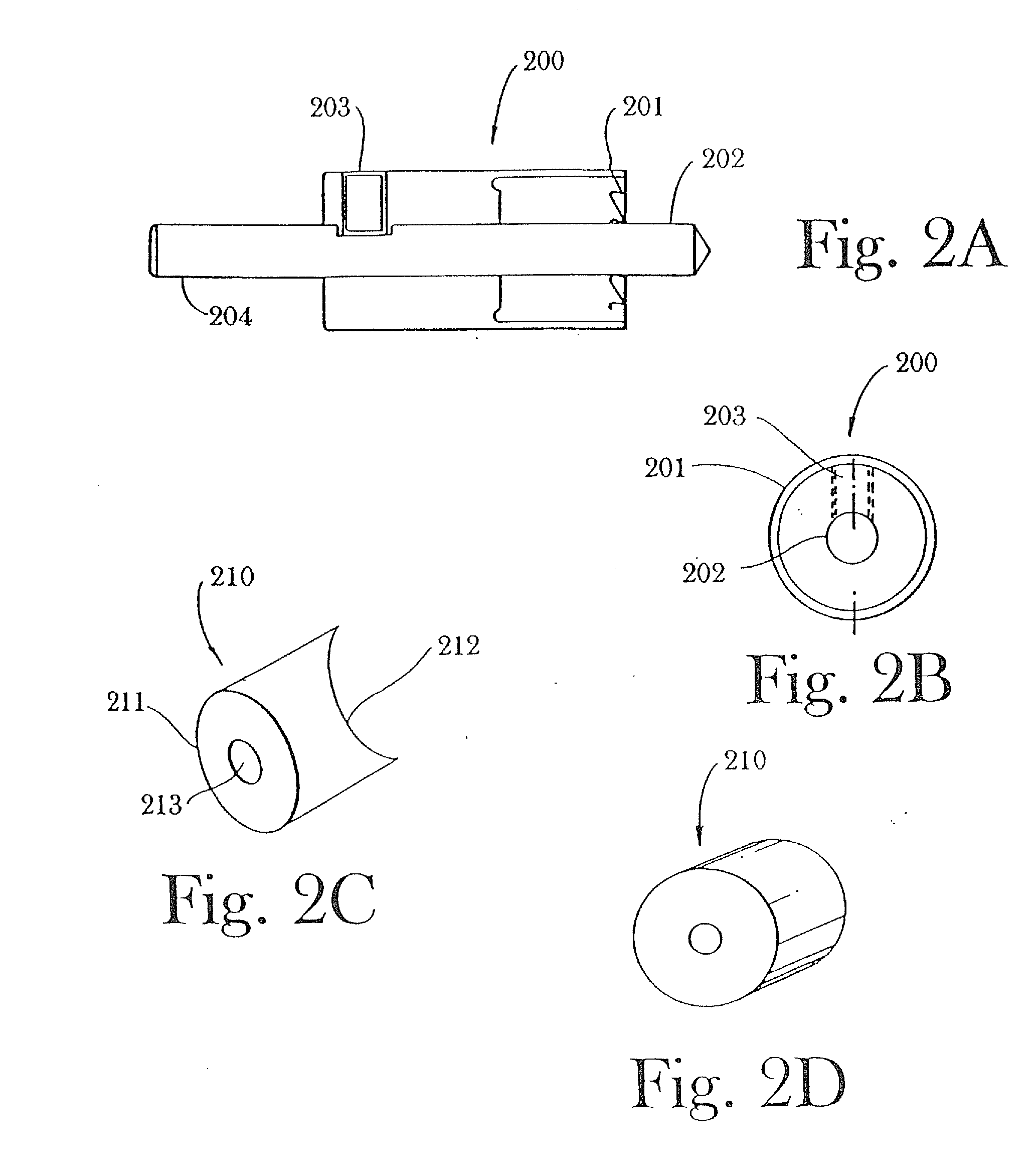 Multi-component cortical bone assembled implant