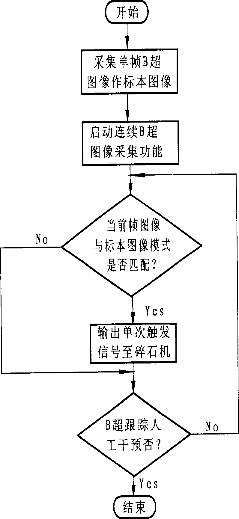 Two-dimensional ultrasonic scanning automatic tracking stone-breaking system of external impact wave stone-breaking machine