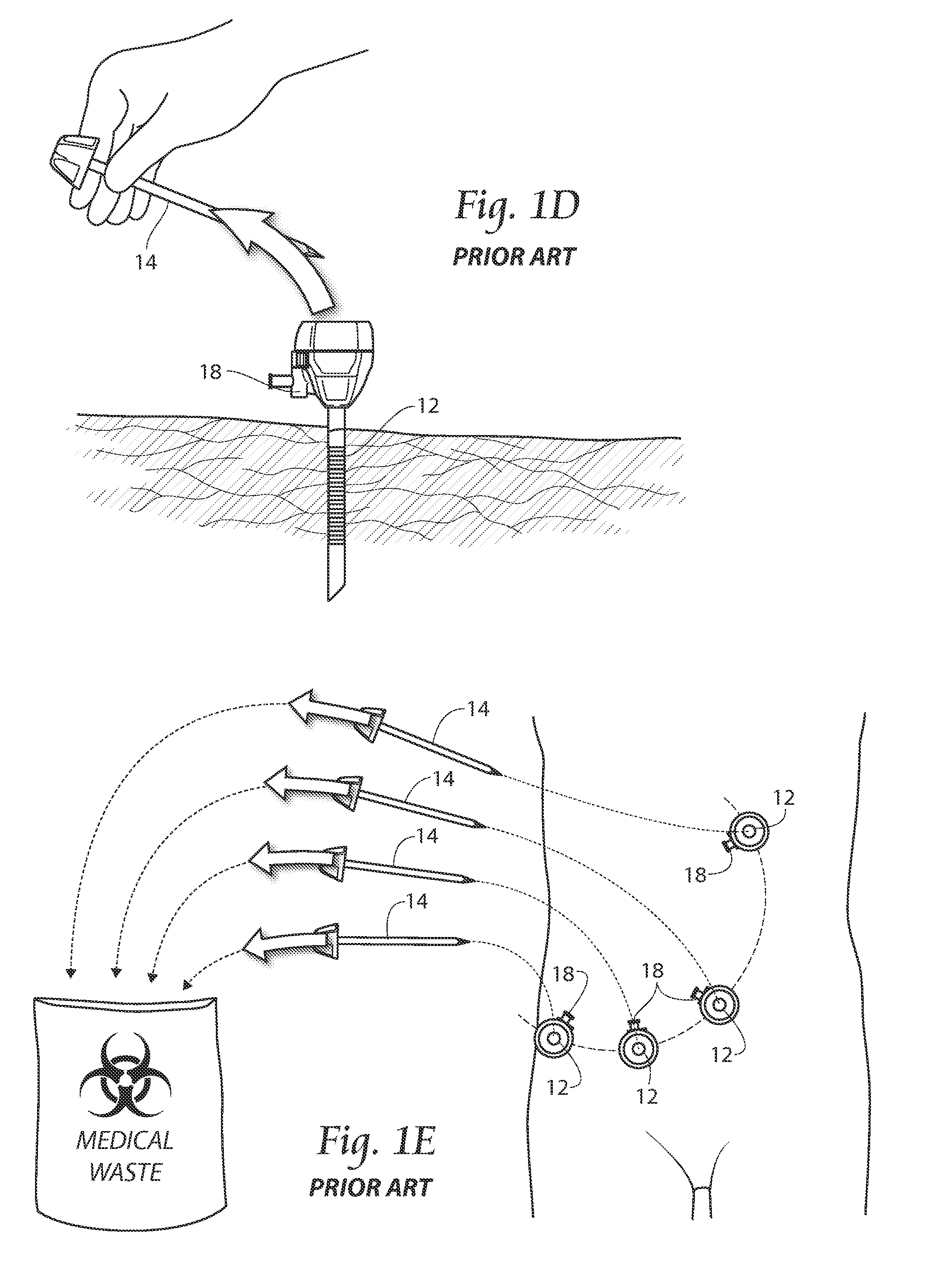 Devices, systems, and methods for performing endoscopic surgical procedures