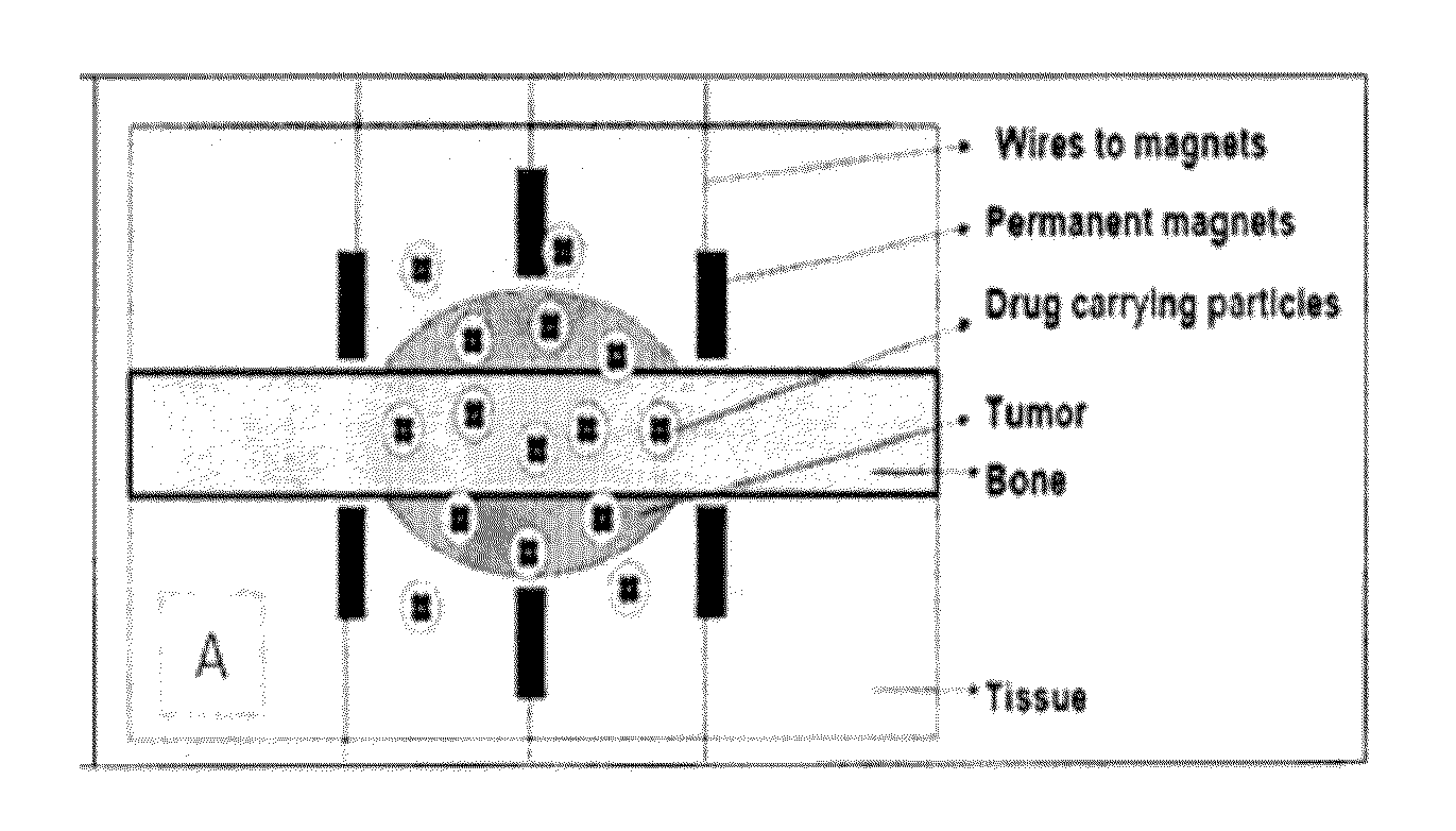 Composite magnetic nanoparticle drug delivery system