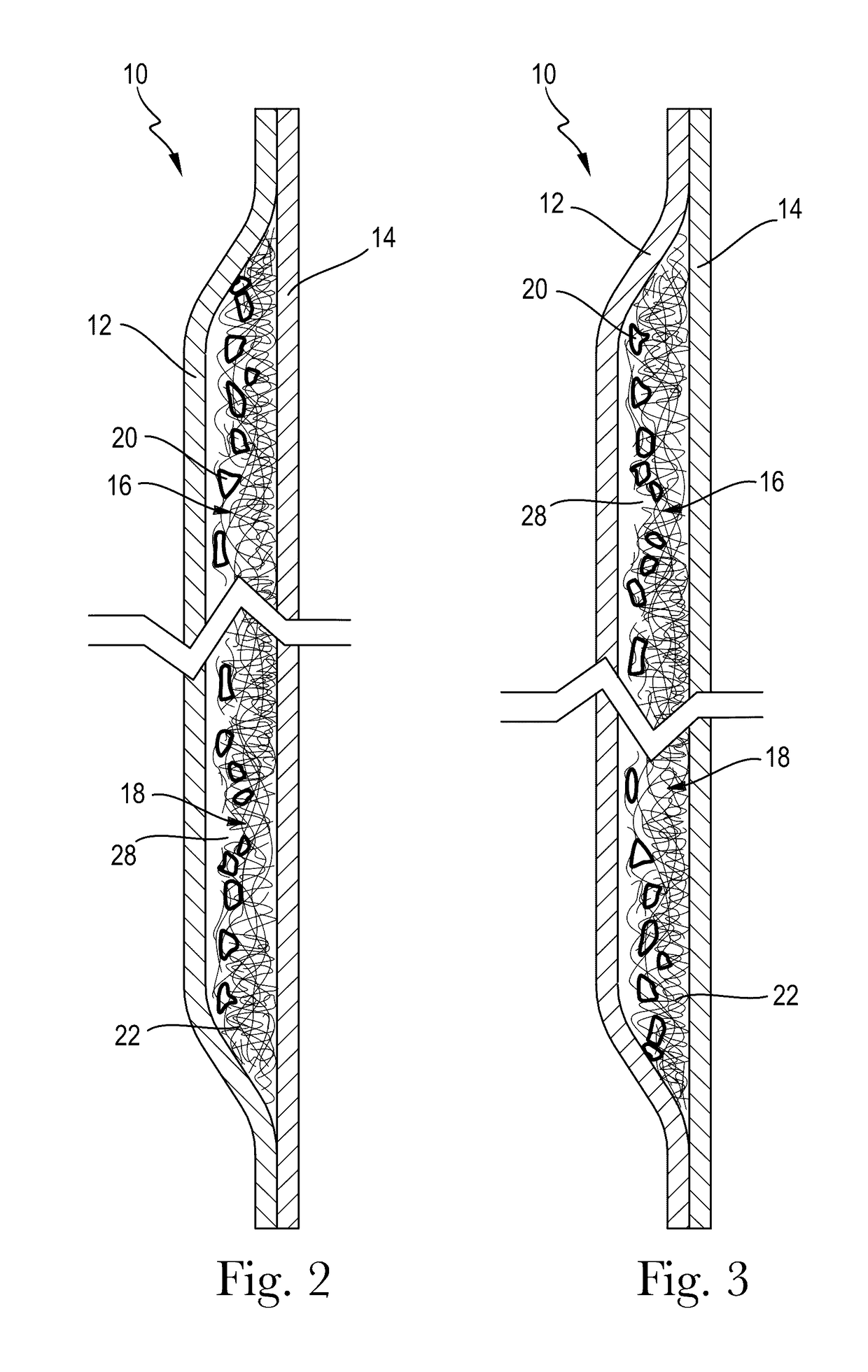 Absorbent structure