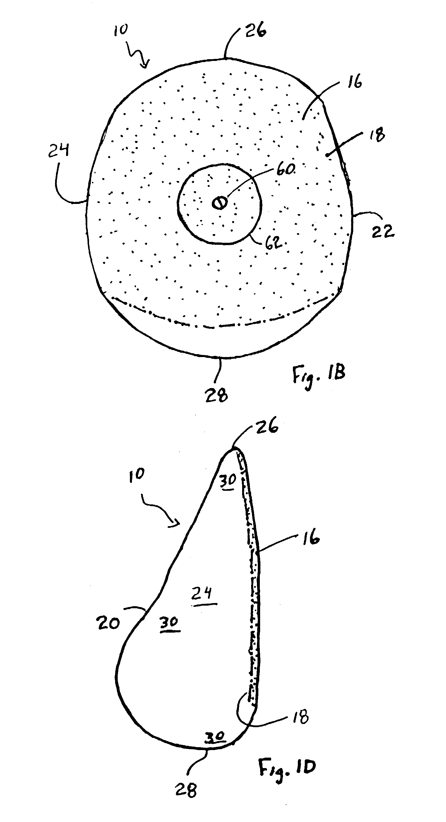 Non-rotating breast implant