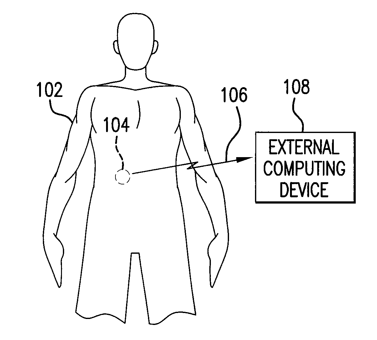 Ingestible Low Power Sensor Device and System for Communicating with Same