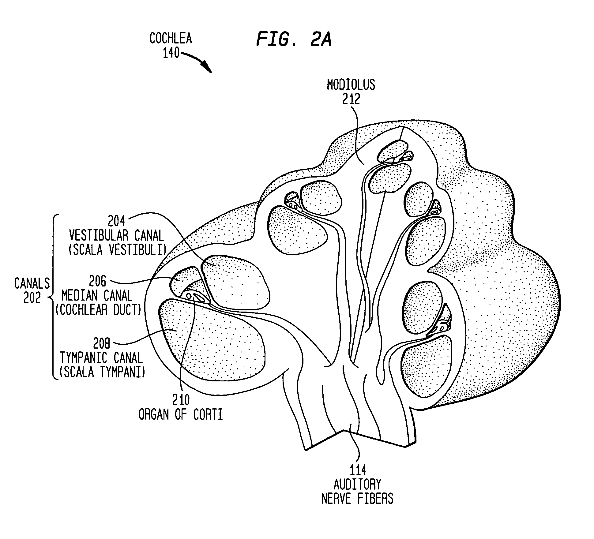 Electrode assembly for a stimulating medical device